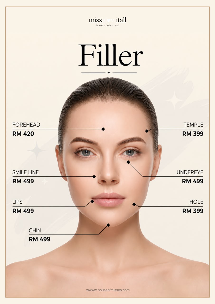 Chin Projection V-Shape Filler